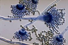 دانلود تصاویر با کیفیت میکروسکوپی قارچ شناسی
